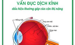 Vẩn đục dịch k&#237;nh: Dấu hiệu thường gặp của cận thị nặng