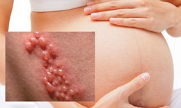 Sự nguy hiểm khi mang thai m&#224; mắc lậu