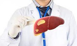 Rối loạn chuyển hóa làm gia tăng bệnh lý gan nhiễm mỡ