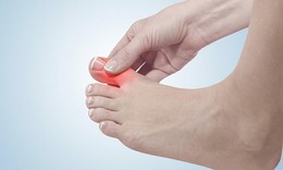 9 thực phẩm người bệnh gout n&#234;n đưa v&#224;o thực đơn h&#224;ng ng&#224;y