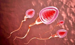 Tinh dịch đổi m&#224;u v&#224; những điều cần lưu &#253; để &#39;tinh binh&#39; khỏe mạnh