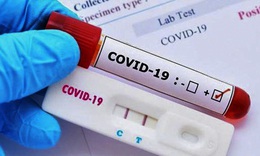 Chiều 26/2: Nhu cầu test x&#233;t nghiệm COVID-19, m&#225;y SpO2 tăng cao, Bộ Y tế y&#234;u cầu đảm bảo nguồn cung