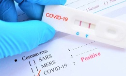 Sử dụng kit test nhanh COVID-19 kh&#244;ng đ&#250;ng, hậu quả kh&#243; lường