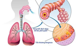 Chỉ thấu t&#225;n - b&#224;i thuốc h&#243;a đờm, chữa ho