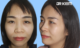 Hiểu đúng về dáng mũi bay đang làm ‘mưa gió’ hiện nay