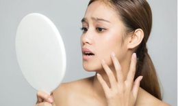 5 dấu hiệu cảnh b&#225;o l&#227;o h&#243;a da kh&#244;ng n&#234;n bỏ qua