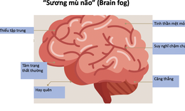 Hậu COVID-19: V&#236; sao c&#243; t&#236;nh trạng &#39;nhớ nhớ qu&#234;n qu&#234;n&#39;, mất tập trung?