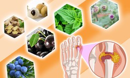 Giải pháp hỗ trợ hạ acid uric máu, kiểm soát bệnh gút