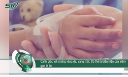 Cảnh gi&#225;c với chứng v&#224;ng da, v&#224;ng mắt: C&#243; thể l&#224; biểu hiện của vi&#234;m gan b&#237; ẩn