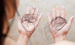 Rụng t&#243;c, kh&#244;ng phải l&#250;c n&#224;o cũng đ&#225;ng lo