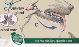 Bệnh dại l&#224; loại virus khiến 100% người mắc tử vong