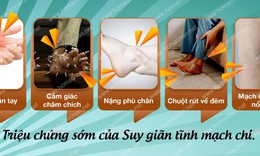 Chuột r&#250;t về đ&#234;m - Dấu hiệu của suy gi&#227;n tĩnh mạch