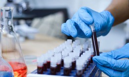 Điều trị tổn thương hậu m&#244;n sớm gi&#250;p giảm nguy cơ ung thư ở người nhiễm HIV