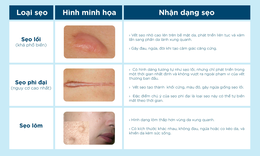 Từ chuy&#234;n gia trị sẹo: 4 tuần – 2 lời khuy&#234;n gi&#250;p l&#224;nh sẹo hiệu quả