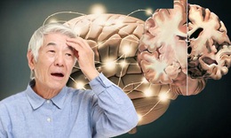 Thuốc tăng động c&#243; thể cải thiện triệu chứng của Alzheimer