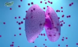 Xơ phổi hậu COVID-19: Chuyên gia chỉ cách điều trị 