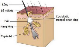 C&#225;ch l&#224;m sạch v&#224; ngăn ngừa tắc lỗ ch&#226;n l&#244;ng