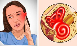 6 dấu hiệu bị nhiễm tr&#249;ng tai v&#224; c&#225;ch ph&#242;ng ngừa