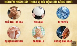 Tho&#225;t vị đĩa đệm cột sống thắt lưng l&#224; g&#236;? Dấu hiệu v&#224; c&#225;ch điều trị