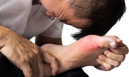 Nguy&#234;n nh&#226;n g&#226;y bệnh gout v&#224; độ tuổi dễ mắc