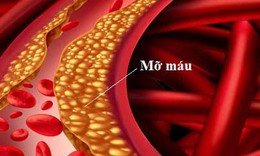 6 b&#224;i thuốc trị bệnh từ hạt muồng (thảo quyết minh)