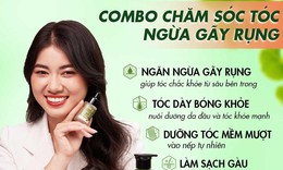 Rụng t&#243;c ‘’h&#243;i đầu’’ – Nỗi lo “kh&#244;ng của ri&#234;ng ai”