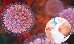 Lưu &#253; khi chăm s&#243;c trẻ bị ti&#234;u chảy do Rotavirus