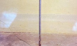 Trẻ 11 tuổi bị thanh sắt d&#224;i đ&#226;m thẳng v&#224;o hậu m&#244;n, trực tr&#224;ng do bạn nghịch dại