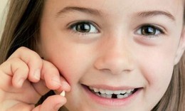 Những l&#253; do ảnh hưởng đến tuổi thay răng của trẻ