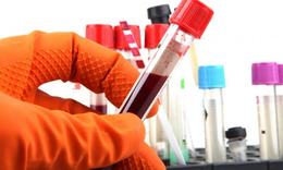 WHO hướng dẫn về x&#233;t nghiệm v&#224; chẩn đo&#225;n STI trong đ&#243; c&#243; HIV