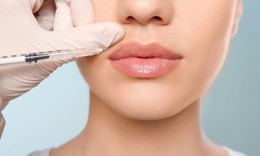 Có nên cấy môi sinh học không?