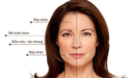 Tất tật c&#225;ch chăm s&#243;c da từ sơ sinh đến người cao tuổi