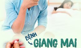 Giang mai kh&#244;ng biểu hiện, l&#224;m thế n&#224;o để biết bệnh?