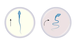 Nam giới rối loạn cương dương, chậm c&#243; con cần biết điều n&#224;y
