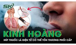 Hút thuốc lá điện tử có thể tổn thương phổi cấp