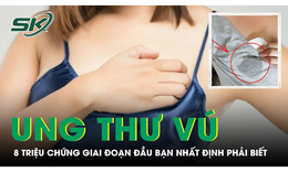 8 triệu chứng ung thư v&#250; giai đoạn đầu bạn đ&#227; biết?