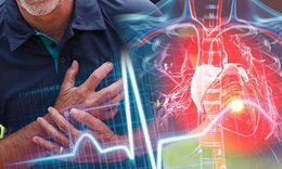 Dấu hiệu cảnh b&#225;o nhồi m&#225;u cơ tim trước v&#224;i ng&#224;y