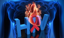 Ph&#242;ng ngừa bệnh tim ở người nhiễm HIV