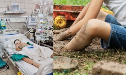 Chơi ngo&#224;i b&#249;n đất bẩn, trẻ 10 tuổi sốc nhiễm khuẩn nặng do vi khuẩn hiếm gặp