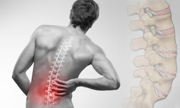 Đau thần kinh toạ ở người trẻ do đ&#226;u v&#224; c&#225;ch khắc phục