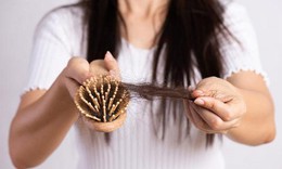 4 thói quen lành mạnh giúp giảm rụng tóc