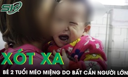 X&#243;t xa b&#233; 2 tuổi bị m&#233;o miệng v&#236; bố mẹ chở đi chơi bằng xe m&#225;y v&#224;o tối muộn