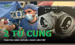 2 tử cung, thai phụ sinh hai b&#233; g&#225;i v&#224;o hai ng&#224;y li&#234;n tiếp