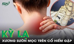 Kỳ lạ xương sườn mọc tr&#234;n... cổ hiếm gặp