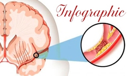 [Infographic] B&#225;c sĩ cảnh b&#225;o những th&#243;i quen h&#224;ng ng&#224;y g&#226;y thiếu m&#225;u n&#227;o