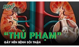 8 th&#243;i quen xấu l&#224; “thủ phạm” g&#226;y n&#234;n bệnh sỏi thận