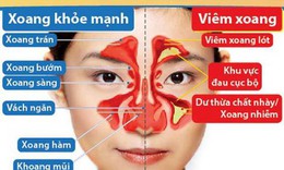 B&#224;i thuốc hỗ trợ điều trị vi&#234;m xoang