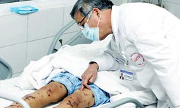 Đ&#227; c&#243; bệnh nh&#226;n nhiễm li&#234;n cầu lợn ở người, Bộ Y tế khuyến c&#225;o g&#236;?