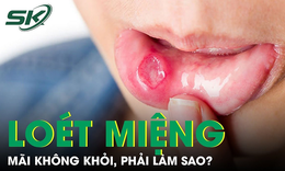 Phải l&#224;m g&#236; khi lo&#233;t miệng kh&#244;ng biến mất?