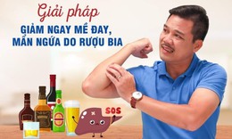 Giải ph&#225;p giảm mề đay, mẩn ngứa do rượu bia